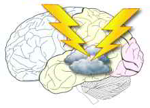 Un ataque es una especie de tormenta eléctrica en el cerebro